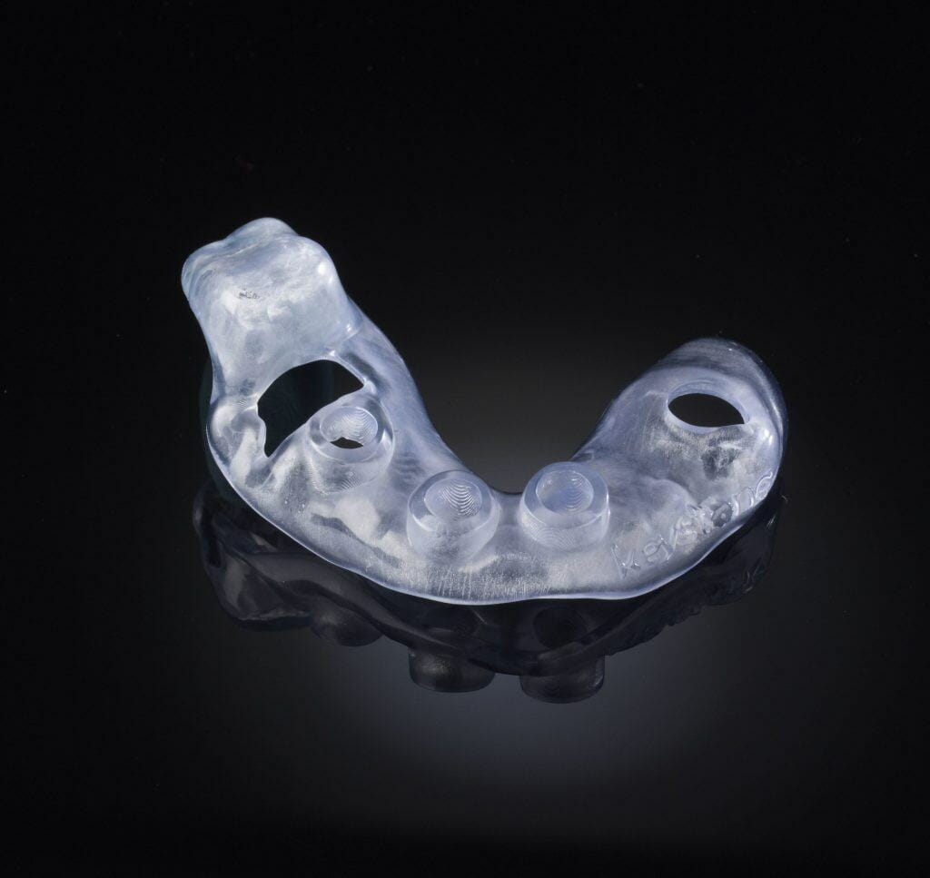 Keystone 3d打印