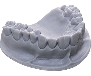 Implant Models