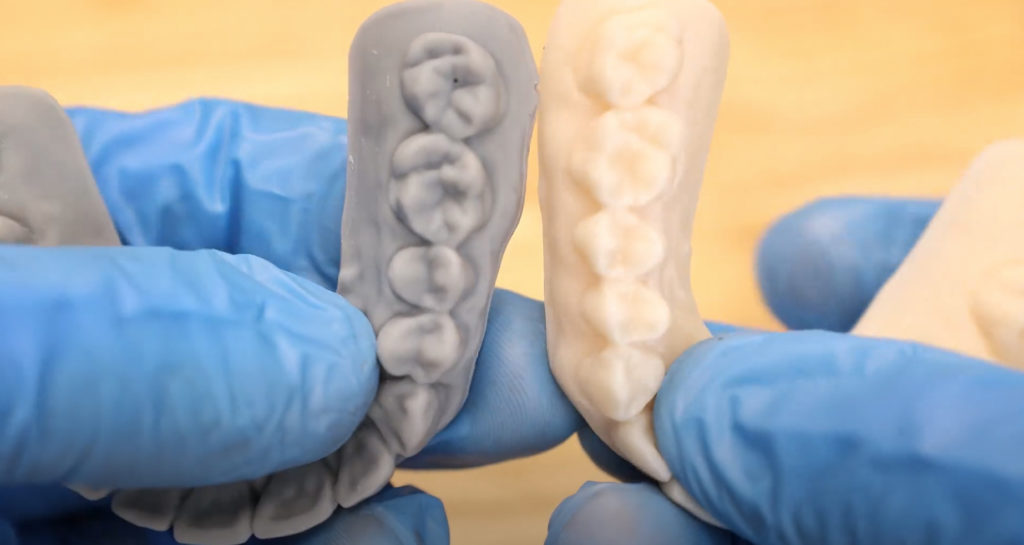 新型3D打印牙科树脂
